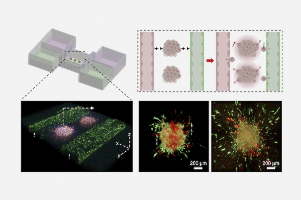 ▲In-vitro metastatic melanoma model manufactured through in-bath 3D bioprinting technology