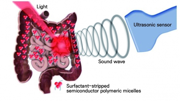 ▲Newly developed photoacoustic imaging technology for deep-tissue image