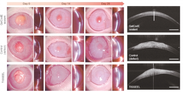 ▲ Continuous membrane of the GelCodE-applied cornea implying that the GelCodE enables corneal remodeling