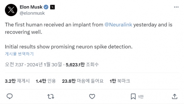 ▲Elon Musk’s post announcing first chip in human brain / X
